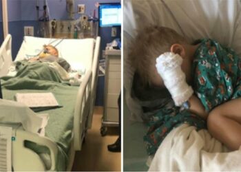 Lille dreng måtte haste opereres efter at have spist populær snack: Nu advarer forældrene